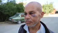 Engelli Adamı Darp Edip Bu Hale Getirdiler: Ailesi Adalet Arıyor!