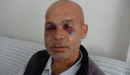 Adana'da Engelli Vatandaşa Şiddet: Gözaltına Alınan Şüpheli Serbest Bırakıldı