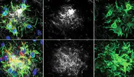 Alzheimer Hastalığında Çığır Açan Tedavi! Bitkin Düşen Beyin Hücreleri Yeniden Programlandı