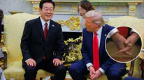 Trump’ın elindeki gizemli leke! Sağlık durumu hakkında yeni iddia