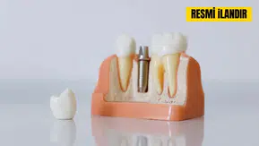 İmplant Malzemesi Satın Alınacak