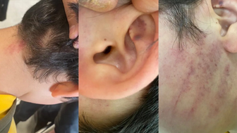 Konya'da Okul Koridorunda Dehşet Anları! 8 Yaşındaki Çocuğa Veli Baskını ve Darp Dehşeti