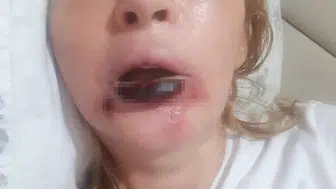 Antalya'da Estetik Faciasında 7 Yıllık Hukuk Çıkmazı