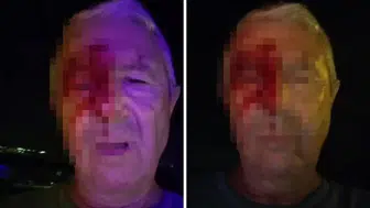 Kocaeli'de Görevi Başındaki Muhabir Tayyar Öztoprak Darp Edildi