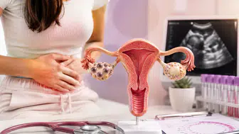 Tıpta Tarihi Değişim: PCOS Neden PMOS Oldu? Belirtileri Ve Güncel Tedavi Yöntemleri