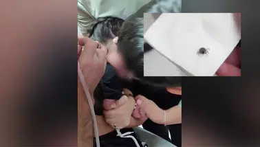 5 Yaşındaki Çocuğun Kulağından Canlı Kene Çıktı!