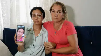 Adana’da Eski Eşinin Şiddetine Maruz Kalan Kadın: “Yaşarken Kurtulayım”