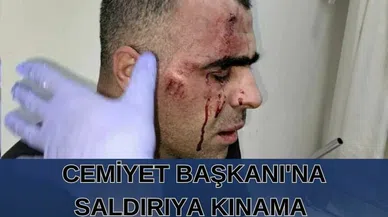 Cemiyet Başkanı’na saldırıya kınama