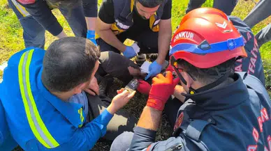 Adana’da Ayağı Testereye Kapılan Vatandaş İçin Saniyelerle Yarışıldı!