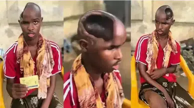 Beyni olmayan adam gerçek mi? Beyin olmadan yaşanabilir mi?