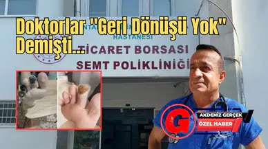 Antalya’da "Kesilecek" Denilen Parmakları Özel Solüsyon Kurtardı