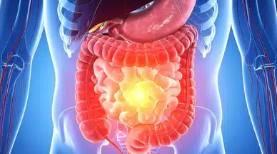 22 Bin Kişi Bu Kansere Yakalanıyor