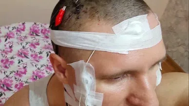 Rüyalarını kontrol edebilmek için kafasını matkapla deldi