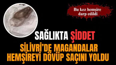 Silivri'de hemşire dövülüp saçı yolundu!