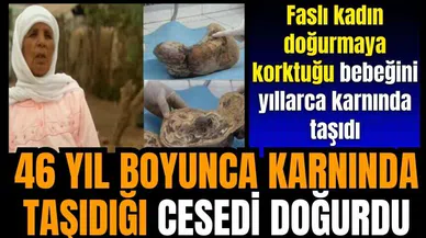 46 yıl boyunca karnında taşıdığı bebeğini doğurdu