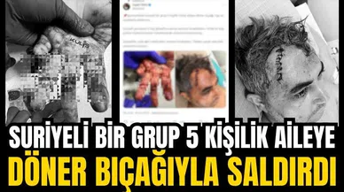 Suriyeliler döner bıçağıyla Türk aileye saldırdı