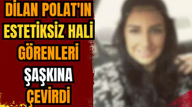 Dilan Polat'ın estetiksiz hali görenleri şaşkına çevirdi!