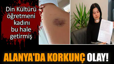 Alanya'da korkunç olay! Din Kültürü öğretmeni, kadını bu hale getirmiş