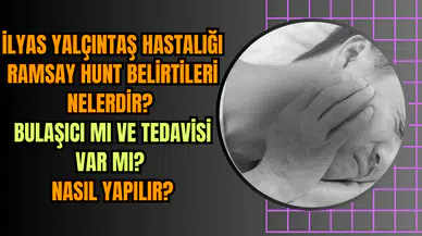 İlyas Yalçıntaş hastalığı Ramsay hunt belirtileri nelerdir? Bulaşıcı mı ve tedavisi var mı? Nasıl yapılır?