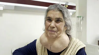 50 Yıldır Doktora Gitmeyen Kadının Vücudundan Öyle Bir Kitle Çıktı Ki Doktorlar Şoke Oldu!