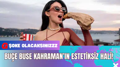 Buçe Buse Kahraman’ın Estetiksiz Hali!