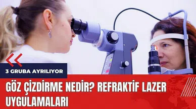 Göz çizdirme nedir? Refraktif lazer uygulamaları