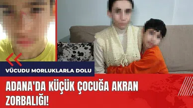 Adana'da küçük çocuğa akran zorbalığı: Vücudu morluklarla dolu