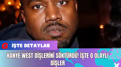 Kanye West Dişlerini Söktürdü! İşte O Olaylı Dişler