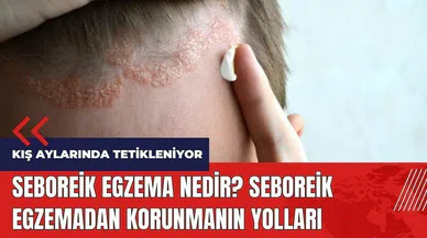 Seboreik Egzema nedir? Seboreik Egzemadan korunmanın yolları