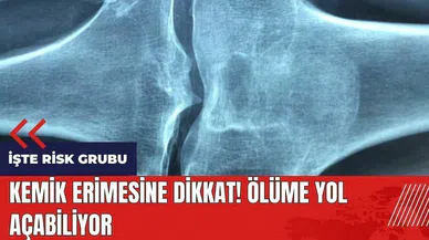 Kemik erimesine dikkat! Ölüme yol açabiliyor
