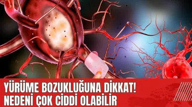 Yürüme bozukluğuna dikkat! Nedeni çok ciddi olabilir