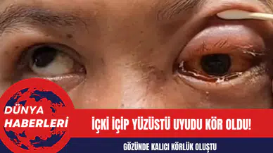 İçki içip yüzüstü uyudu kör oldu!