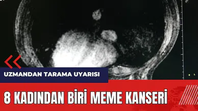 8 kadından biri meme kanseri! Uzmandan tarama uyarısı