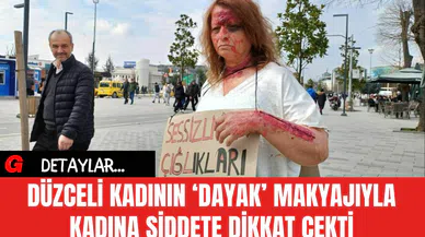 Düzceli Kadının 'Dayak' Makyajıyla Kadına Şiddete Dikkat Çekti