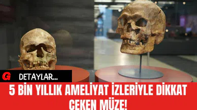 5 Bin Yıllık Ameliyat İzleriyle Dikkat Çeken Müze!