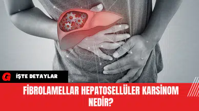 Fibrolamellar Hepatosellüler Karsinom Nedir?