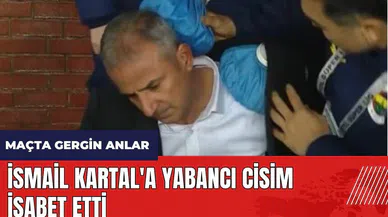 İsmail Kartal'a yabancı cisim isabet etti