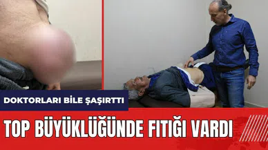 Mersin'de top büyüklüğünde fıtık doktorları bile şaşırttı