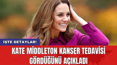Kate Middleton kanser tedavisi gördüğünü açıkladı