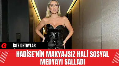 Hadise’nin Makyajsız Hali Sosyal Medyayı Salladı