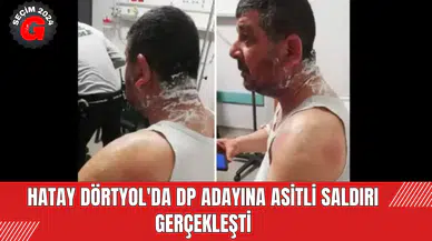 Hatay Dörtyol'da DP Adayına Asitli Saldırı Gerçekleşti