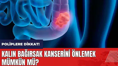 Kalın bağırsak kanserini önlemek mümkün mü?