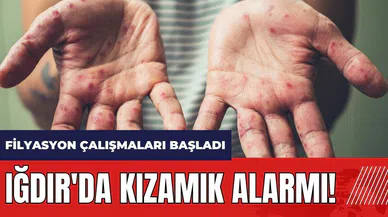 Iğdır'da kızamık alarmı! Filyasyon çalışmaları başladı