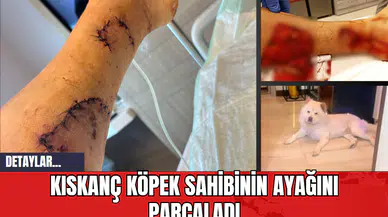 Kıskanç Köpek Sahibinin Ayağını Parçaladı