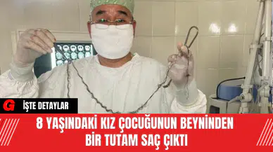 8 Yaşındaki Kız Çocuğunun Beyninden Bir Tutam Saç Çıktı