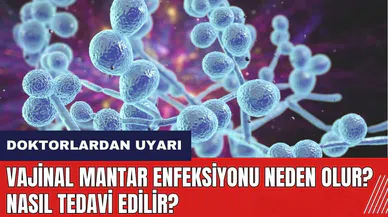 Vajinal Mantar Enfeksiyonu neden olur? Nasıl tedavi edilir?