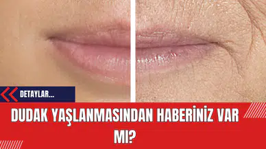 Dudak Yaşlanmasından Haberiniz Var Mı?