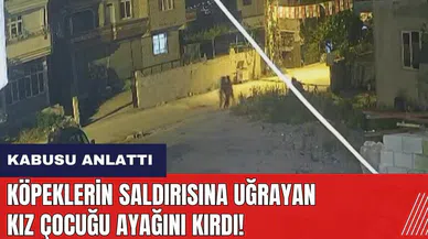 Köpeklerin saldırısına uğrayan kız çocuğu ayağını kırdı!