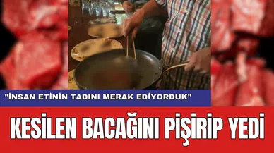 Kesilen Ampute Bacağını Pişirip Yedi
