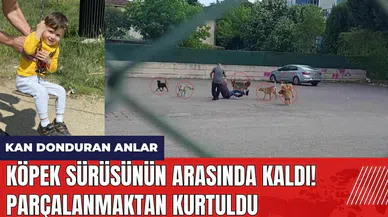 Parçalanmaktan kurtuldu! 10 köpeğin saldırısına uğradı